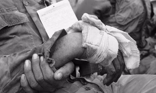 Binh lính Sài Gòn với cánh tay bị thương chờ đến lượt được y tá điều trị.