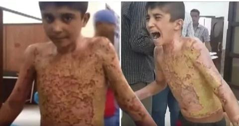 Sat thuong kinh hoang cua vu khi phot pho Tho Nhi Ky