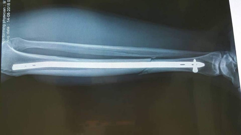 Canh sat co dong bi thieu nu lai xe tong guc gio ra sao?