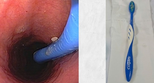 Nguoi phu nu nuot ca ban chai danh rang... khi “giai cuu” nghen hong-Hinh-2