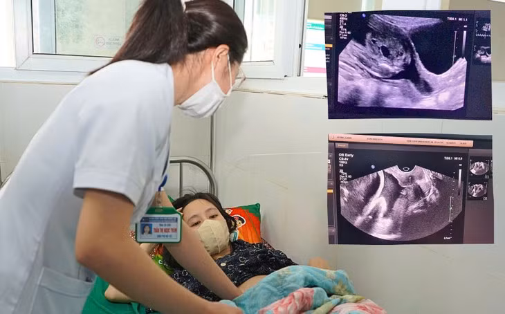 Cuu song thai nhi 22 tuan nho thu thuat khau vong tu cung