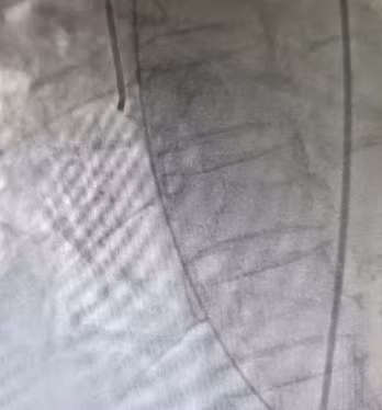 Dang hoi suc tich cuc do chan thuong so nao thi “vo tim”-Hinh-4