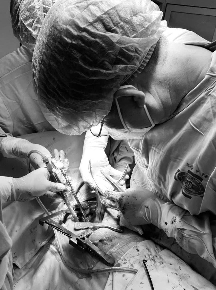 Dau tuc nhe khi van dong canh tay khong ngo u xuong suon-Hinh-3