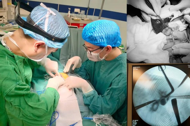 Bé gái 1 tháng tuổi bị teo mật bẩm sinh Be gai 1 thang tuoi bi teo mat bam sinh