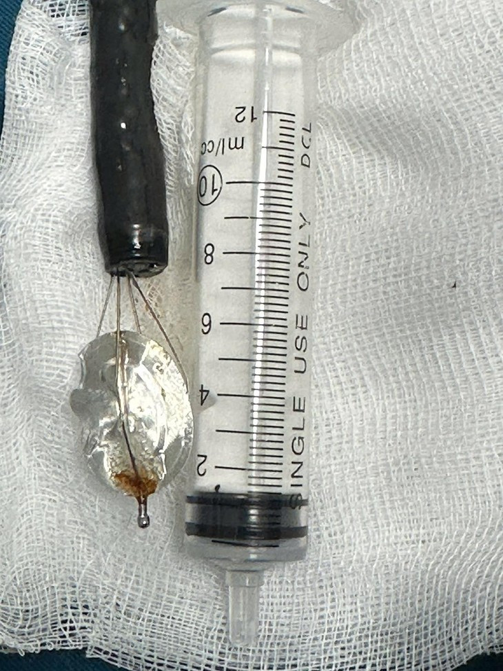 Be trai 11 tuoi nuot nap lon nuoc ngot vao bung