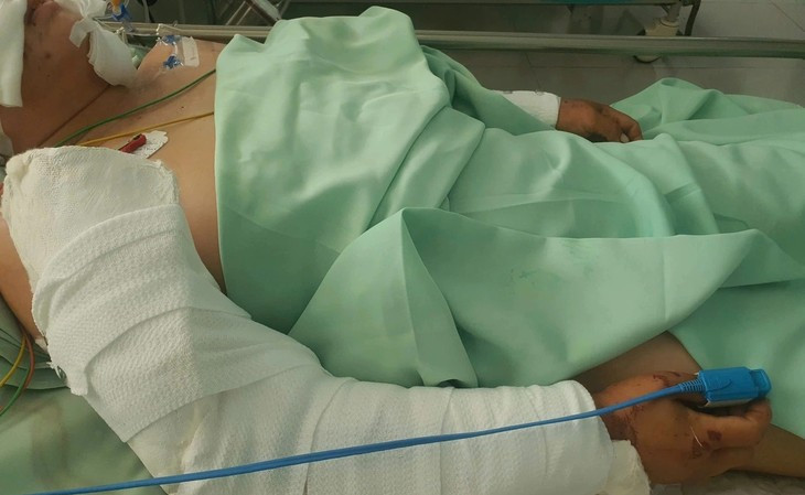 Nguoi phu nu bi cho pitbull can dut tai, chan thuong nguy kich-Hinh-2