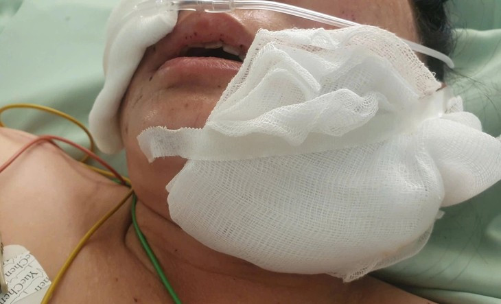 Nguoi phu nu bi cho pitbull can dut tai, chan thuong nguy kich