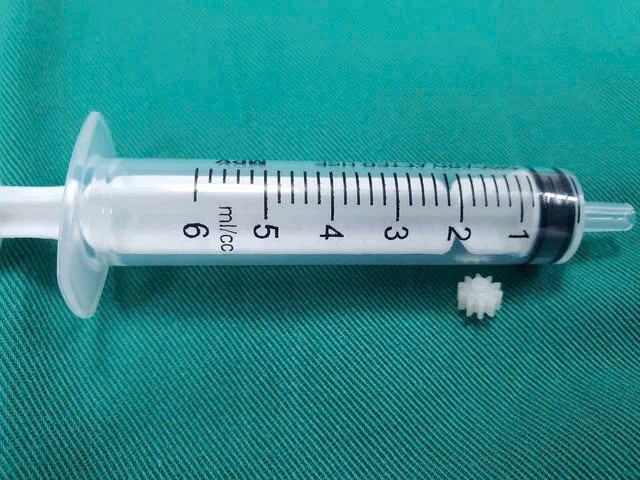 Nhieu tre hoc di vat nhap vien, chuyen gia chi cach xu ly dung-Hinh-2