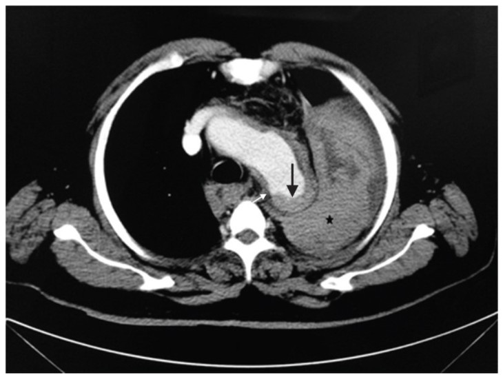 Nguoi dan ong 50 tuoi tu vong sau cu hat hoi