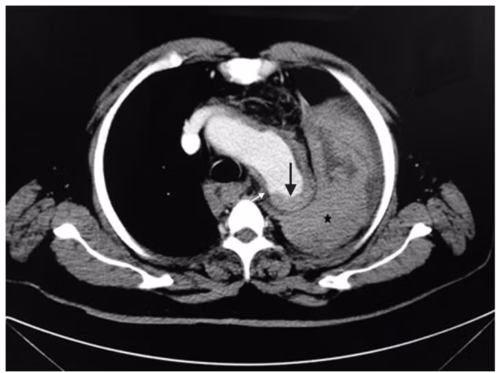 Nguoi dan ong 50 tuoi tu vong sau cu hat hoi
