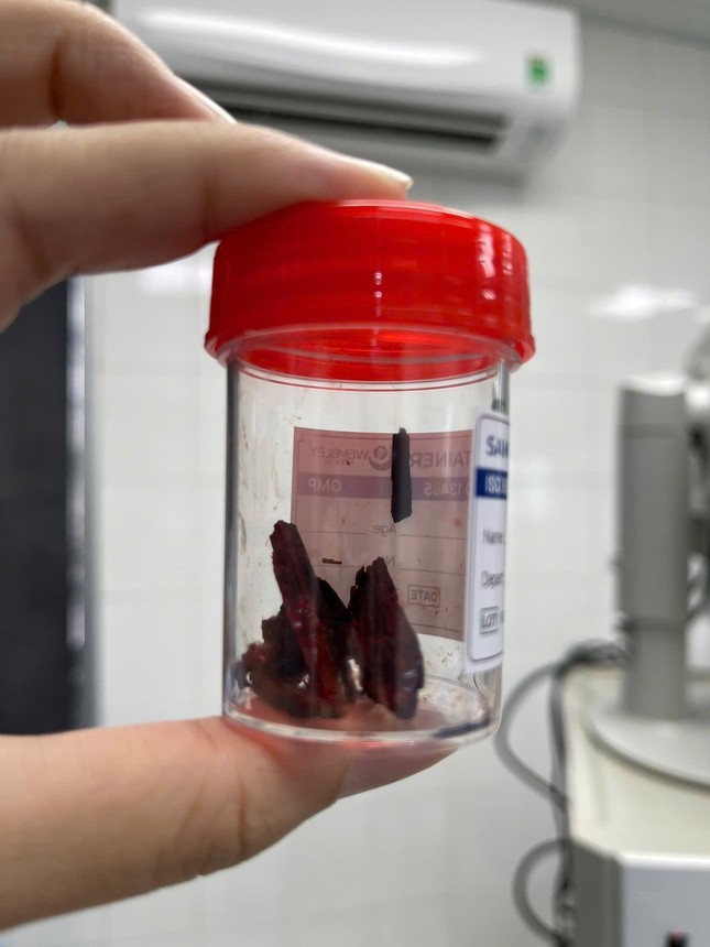 Manh go dai nam trong hoc mat nam thanh nien suot 1 thang