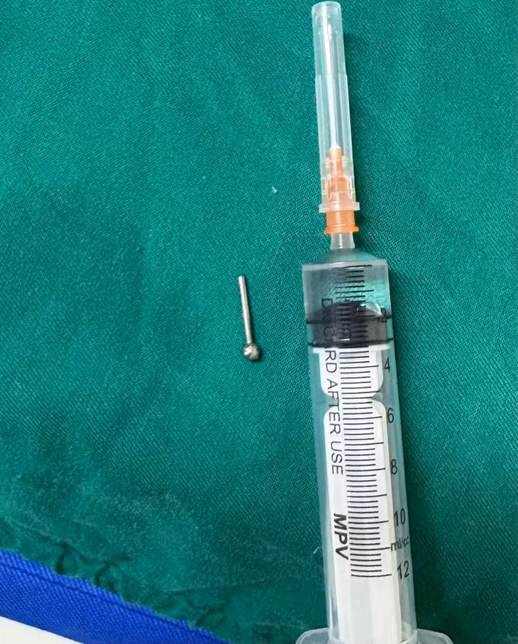 Co gai 19 tuoi thung da day vi nuot phai khuyen deo luoi-Hinh-3