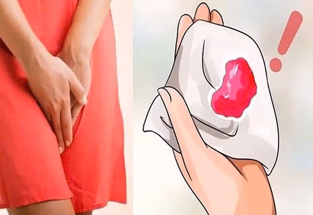 Ra mau sau man kinh, phat hien ung thu niem mac tu cung