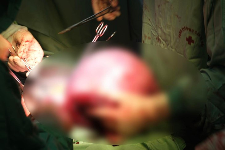 Nguoi phu nu 54 tuoi hanh phuc don con dau long chao doi