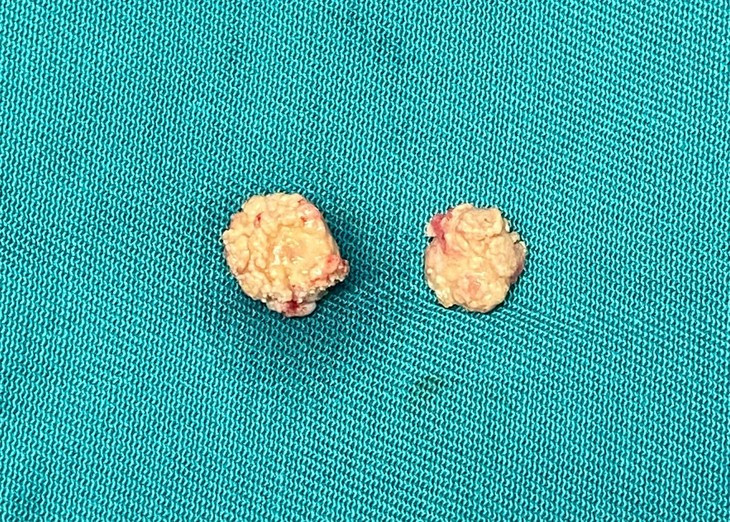 Nguoi dan ong sung dau vung ham khong ngo soi tuyen nuoc bot-Hinh-2