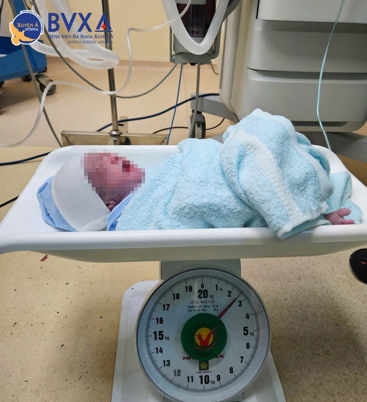 Cuu cap song sinh mac hoi chung truyen mau song thai-Hinh-2