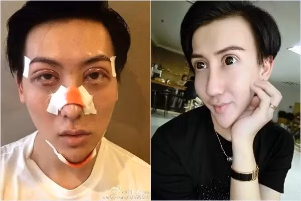 Thời gian trôi qua, hiện tượng mạng này cũng không còn được quan tâm nhiều như trước, đặc biệt cư dân mạng ít khi thấy Lưu Tử Thần xuất hiện trên MXH.