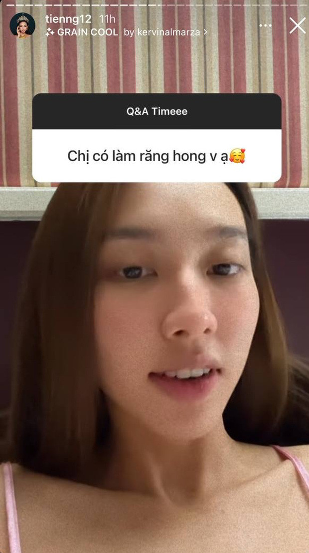 Mới đây, thông tin Thùy Tiên hé lộ chuyện từng "dao kéo" một điểm trên gương mặt để hút hồn, thần thái hơn đã khiến nhiều cư dân mạng chú ý.