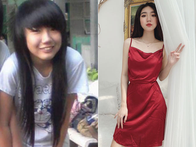 Điều khiến Đan Anh chật vật và tổn thương trong thời gian dài là hàm răng hô. Nỗ lực thay đổi ngoại hình, Đan Anh đã thay đổi cả số phận của mình bởi cú “lột xác” nhan sắc ngoạn mục.