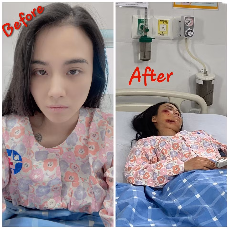 Những hình ảnh tàn tạ của Linh Miu khi đóng phim luôn làm netizen tỏ ra sốc, lo lắng trước tình trạng này của Linh Miu. Tuy nhiên, để vai diễn được hoàn hảo nên cô phải hóa trang, thực tế là Linh Miu đang cố gắng làm tròn vai của mình.