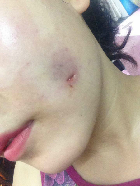 Từ một cô gái sở hữu nhan sắc cuốn hút, cô gái trong câu chuyện bỗng nhiên phải nhận một vết sẹo trên khuôn mặt, tâm lý cũng bị ảnh hưởng nặng nề. 