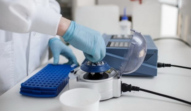 Cac nuoc tiem phong benh lao co ty le tu vong do COVID-19 thap hon-Hinh-3