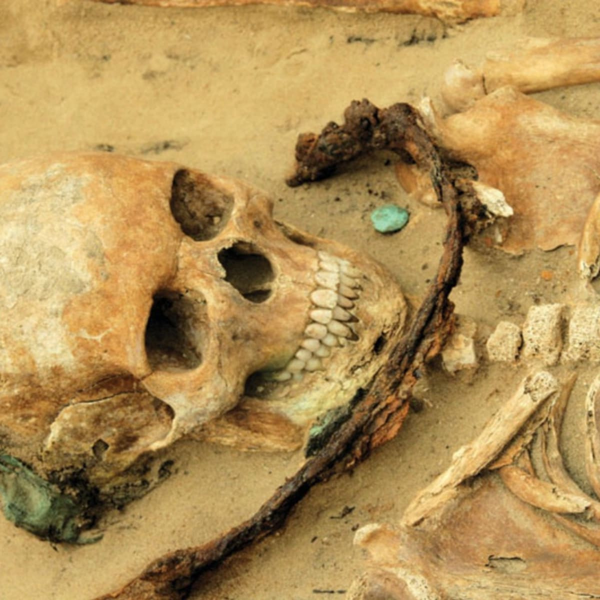 Ngoài ra, người xưa còn suy luận những người có các đặc điểm đặc biệt trên cơ thể như vết bớt có khả năng bị xếp vào những đối tượng có quyền lực siêu nhiên.