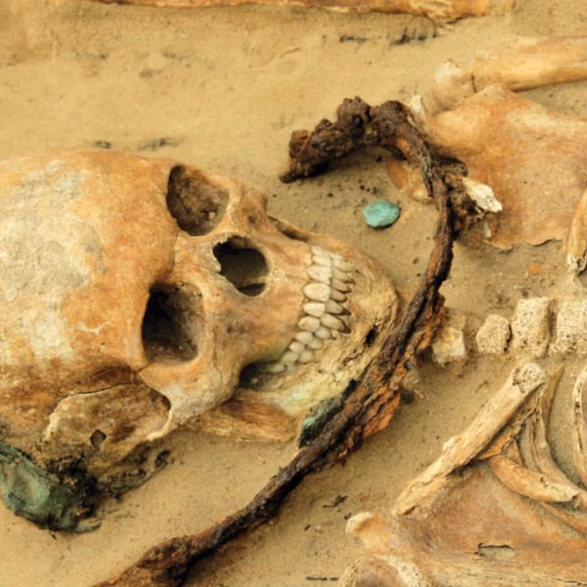 Ngoài ra, người xưa còn suy luận những người có các đặc điểm đặc biệt trên cơ thể như vết bớt có khả năng bị xếp vào những đối tượng có quyền lực siêu nhiên.