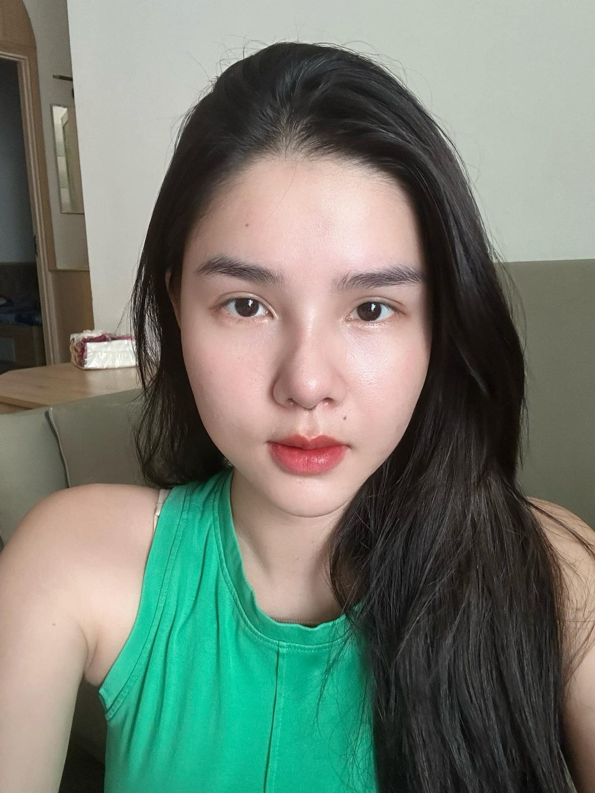 Cô cũng chia sẻ thêm về việc Mạc Hồng Quân không ủng hộ vợ phẫu thuật thẩm mỹ từ nhiều năm nay, song ở lần này vì mũi của cô gặp vấn đề nên ông xã bắt buộc phải đồng ý. Ảnh: FBNV