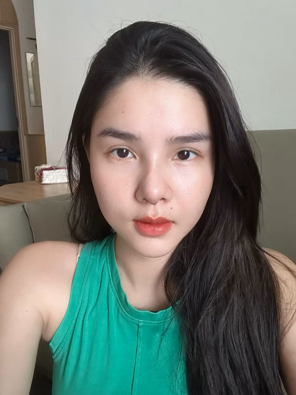 Cô cũng chia sẻ thêm về việc Mạc Hồng Quân không ủng hộ vợ phẫu thuật thẩm mỹ từ nhiều năm nay, song ở lần này vì mũi của cô gặp vấn đề nên ông xã bắt buộc phải đồng ý. Ảnh: FBNV