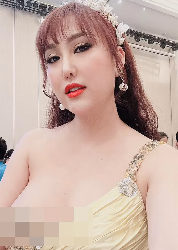 Người đẹp sinh năm 1982 từng nâng ngực, bơm vòng ba lên 104 cm, sửa mũi, nhuộm da, độn cằm, chỉnh răng...