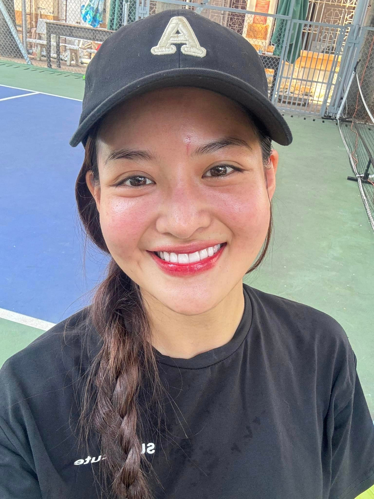 Tối 12/8, Thùy Anh gặp tai nạn trong quá trình quay phim ở Phú Yên do bạn diễn vô tình vung điện thoại trúng vào mặt cô để lại sẹo lớn. Ảnh: FB Thuỳ Anh