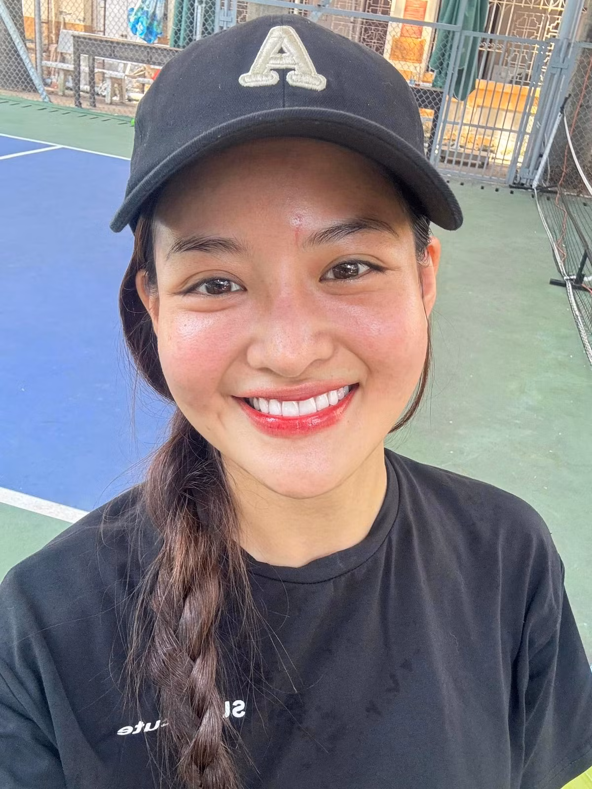 Tối 12/8, Thùy Anh gặp tai nạn trong quá trình quay phim ở Phú Yên do bạn diễn vô tình vung điện thoại trúng vào mặt cô để lại sẹo lớn. Ảnh: FB Thuỳ Anh