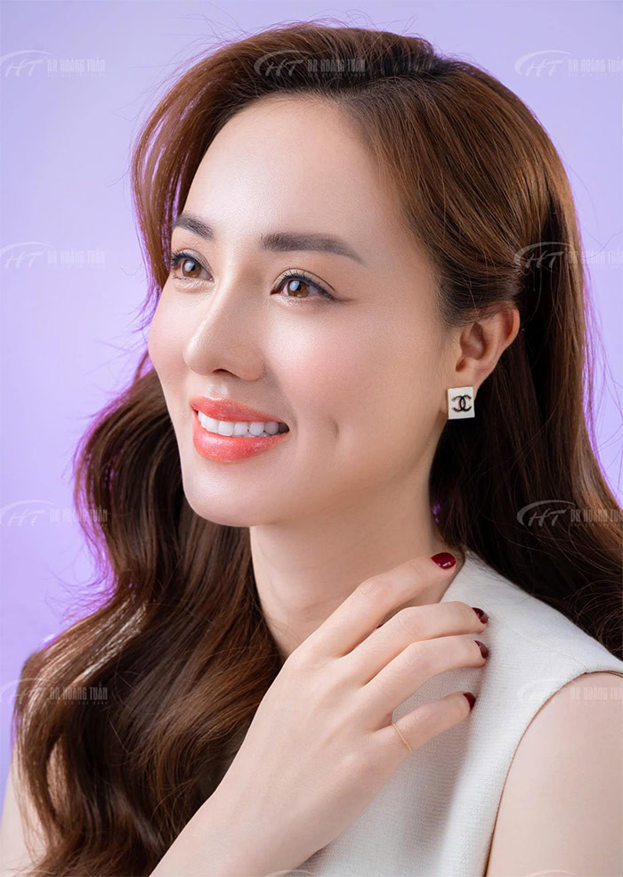 Mới đây trên trang cá nhân, Ngọc Hà - vợ NSND Công Lý đã khoe cô vừa sửa lại mũi. (Ảnh: FB Hoàng Thanh Tuấn)