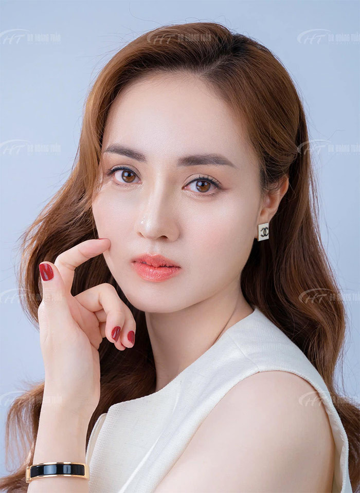 Ngọc Hà cho biết cô từng sửa mũi cách đây 14 năm nhưng hiện tại dáng mũi này không thấy phù hợp nữa nên quyết tâm chỉnh sửa lại. (Ảnh: FB Hoàng Thanh Tuấn)