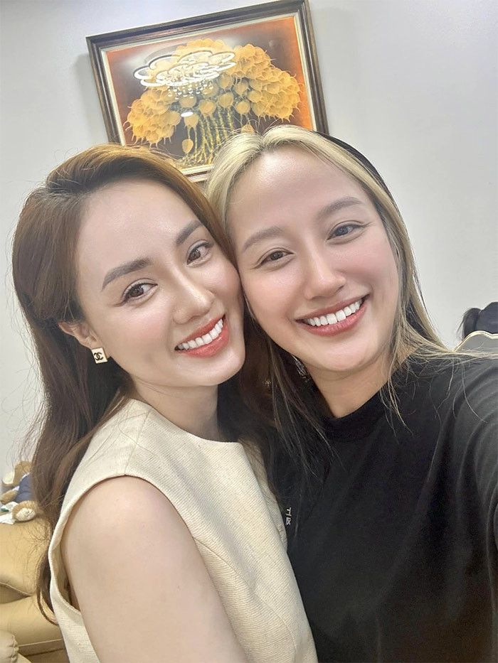 Ngọc Hà cho biết cô được chồng ủng hộ việc đi sửa mũi lần thứ hai. (Ảnh: FB Nga Nguyễn)