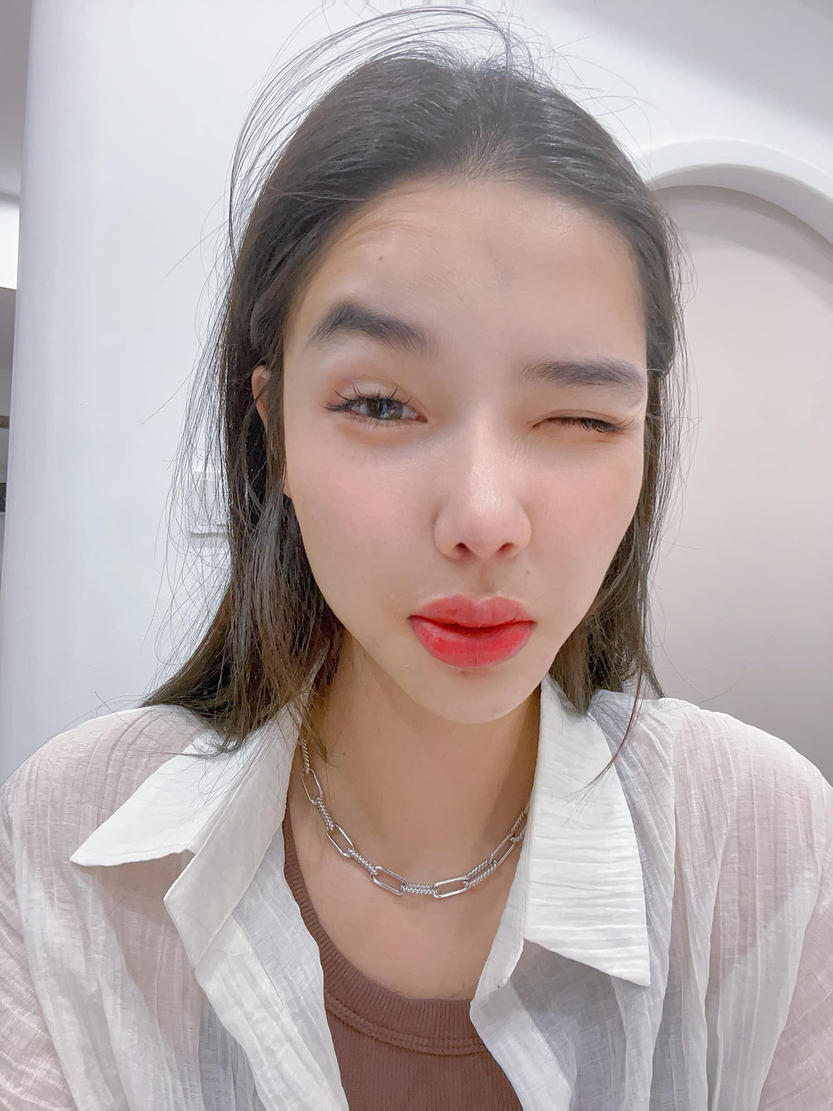 Cựu mẫu Kỳ Hân bất ngờ lộ diện với đôi môi sưng tều. Ảnh: FB Han Ky Nguyen