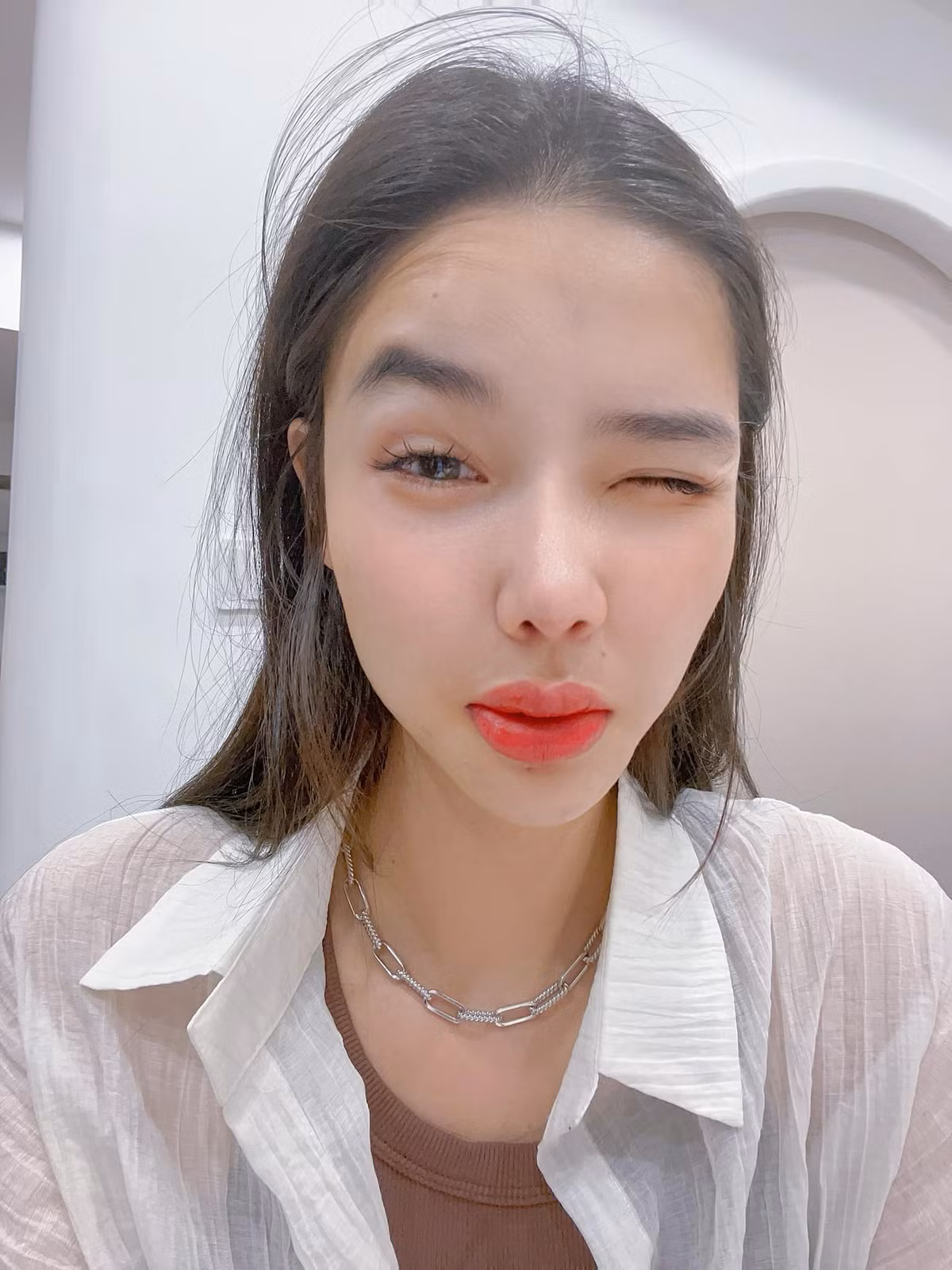 Cựu mẫu Kỳ Hân bất ngờ lộ diện với đôi môi sưng tều. Ảnh: FB Han Ky Nguyen