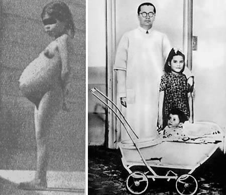 Một người phụ nữ mang đứa con gái của mình và năn nỉ bác sĩ hãy xua đuổi ma quỷ trong người con gái mình. Ban đầu, bác sĩ chẩn đoán cô bé có một khối u. Tuy nhiên, ông hết sức ngạc nhiên khi phát hiện ra cô bé đã mang thai tám tháng. Cô bé trở thành "bà mẹ trẻ nhất" khi mới 5 tuổi.