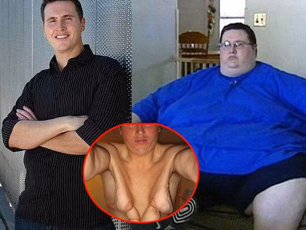 Uống nhiều nước là biện pháp hữu hiệu nhất để phục hồi làn da sau khi phẫu thuật. 