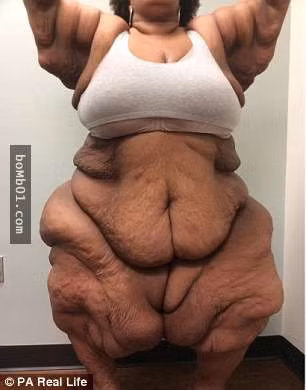 Để làn da có thể căng mịn một cách tự nhiên, là điều rất khó xảy ra. Tuy nhiên, với nền y học hiện đại như ngày nay, người ta hoàn toàn có thể can thiệp bằng phương pháp phẫu thuật.