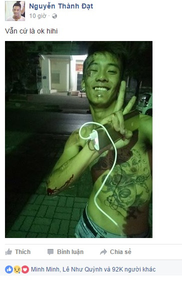 Trước khi chuyện bất trắc xảy ra, Đạt Cỏ trong mắt bạn bè, cư dân mạng Việt là một chàng trai trẻ tuổi đầy tài năng. Cậu chinh phục các khán giả trẻ bằng những bản cover ngọt ngào, giàu tình cảm và một giọng hát đầy nội lực, giống hệt ca sĩ Tuấn Hưng. Bức ảnh selfie được Đạt Cỏ - Nguyễn Thành Đạt chụp ngay sau khi gặp tai nạn vào đêm 7/11 vừa qua đã phần nào thể hiện được cá tính vui vẻ, hòa nhã và một chút ngông cuồng của tuổi trẻ. Và thật không ngờ đó lại là hình ảnh cuối cùng mà Đạt Cỏ để lại và chính nó cũng khiến nhiều người bàng hoàng khi chỉ vài giờ sau khi bức ảnh được đăng tải, chàng trai quê gốc Sơn Tây đã trút hơi thở cuối cùng.