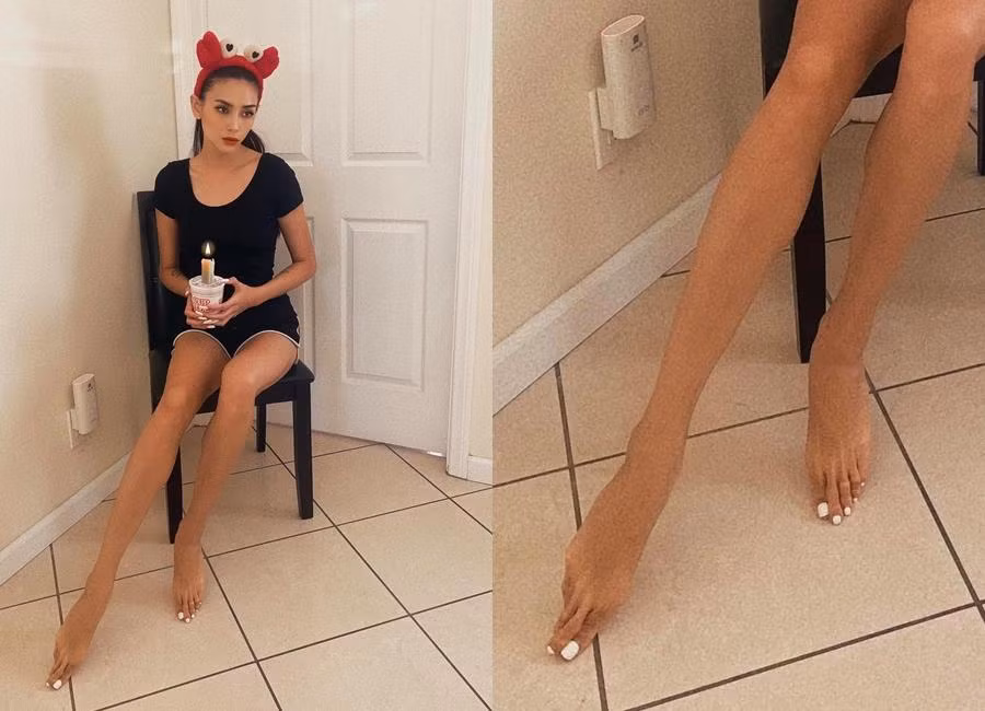 Vo Hoang Yen lo ngon chan dai nhu ngon tay nguoi khac-Hinh-2