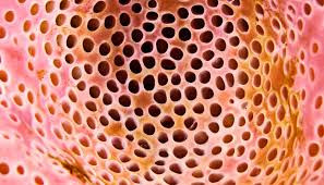 Những trường hợp mắc hội chứng sợ lỗ (Trypophobia) thường, run rẩy, tim tăng nhanh khi nhìn thấy những thứ có nhiều lỗ như tổ ong.