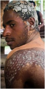 Tập tục này của người Chambri được cho xuất phát từ truyền thuyết của người dân bản địa. Họ tin rằng, vào thời xa xưa, loài cá sấu di cư từ sông Sepik đi theo hồ Chambri vào đất liền và tiến hóa thành con người. Ảnh: pagahill.