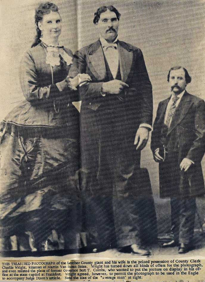 Anna cùng với "chú lùn" Tom Thumb trở thành nhân vật nổi tiếng của bảo tàng với chiều cao trái ngược. Họ đã trở thành nhân vật hấp dẫn đối với khách tham quan khi tới bảo tàng.