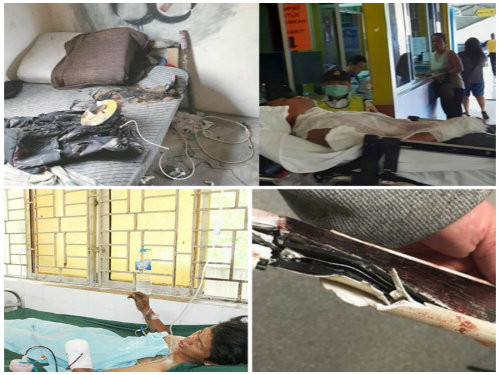 Dien thoai phat no ngay tren nguc vi thoi quen nhieu nguoi dang mac