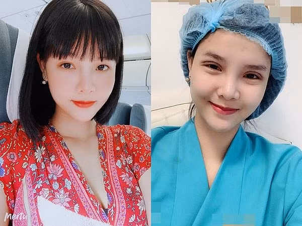 Ky Han thua nhan: 'Neu khong dao keo thi toi xau toi vo cung'