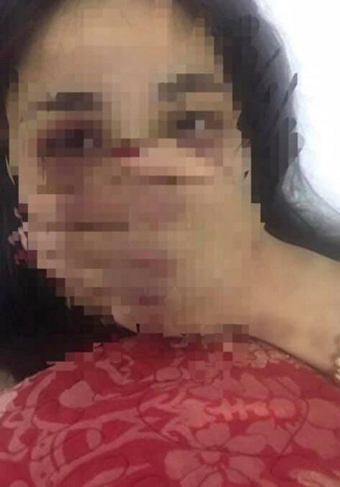 Bac si danh nu thuc tap sinh: “Lo” goc khuat “den” cua ong L.Q.H.P