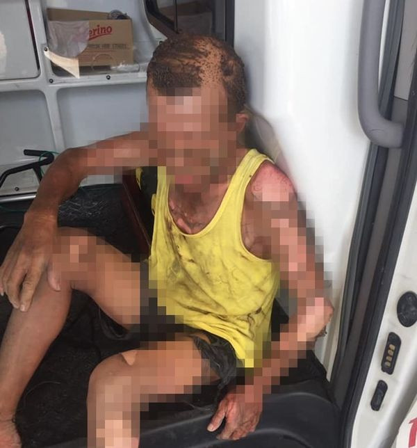 Bo dang an com bi con do xang cham lua dot